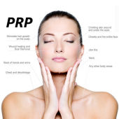 PRP-for-Facial-Rejuvenation-640W